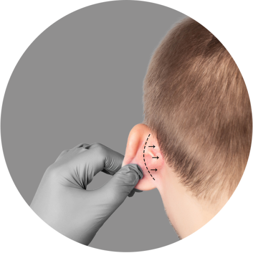 #Clínica de Estética em Brasília; #Clínica no Sudoeste; #Estética Avançada #Otomodelação; #Harmonização de Orelhas #orelhas de abano #otoplástia